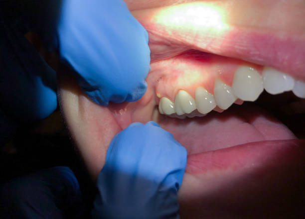 Best Emergency Treatment for Jaw Pain or Injury in Charleston, IL
