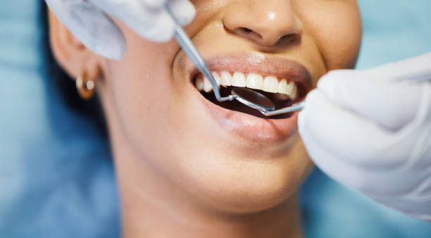 Best Emergency Treatment for Oral Infections in Charleston, IL